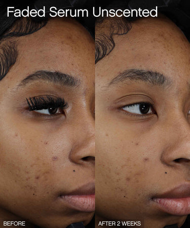 Faded Brightening & Clearing Serum