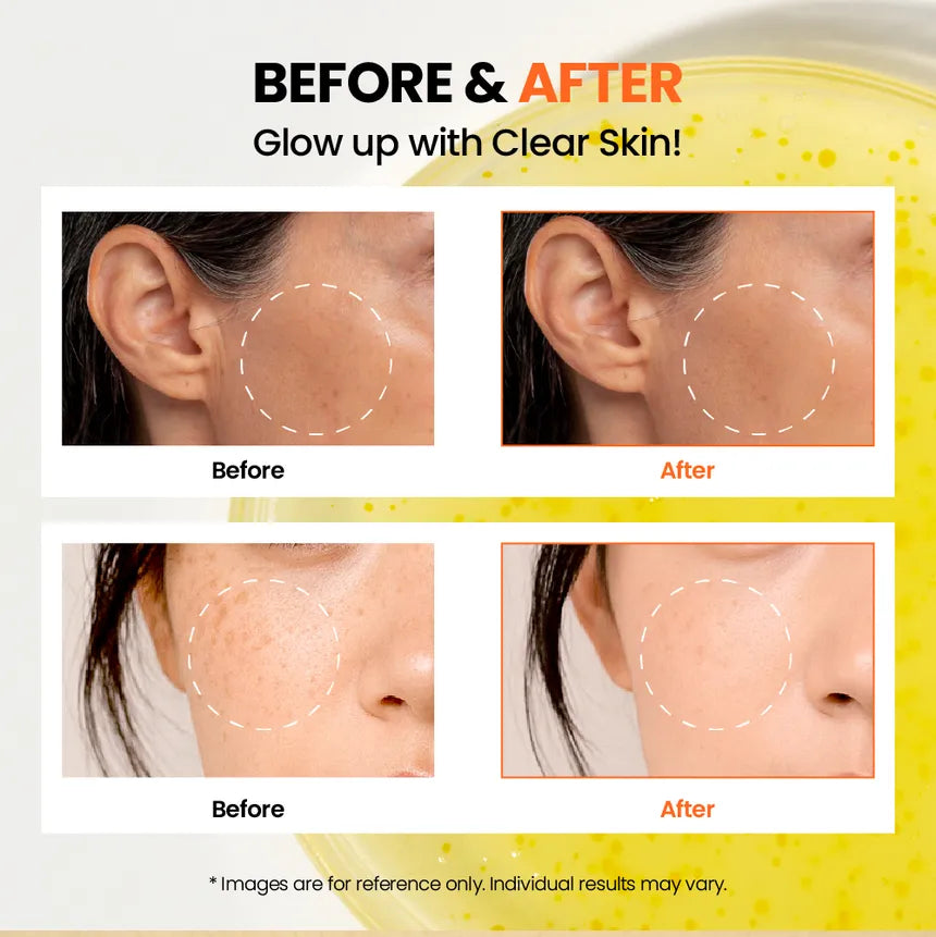 Seoul 1988 Glow Serum — Niacinamide 15% + Yuja
