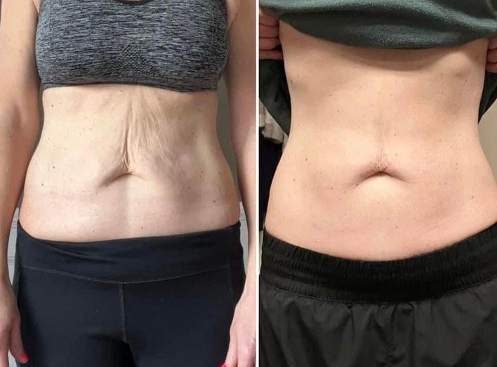 🐝 Botox Bee Venom Anti-Aging Cream