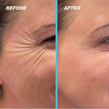🐝 Botox Bee Venom Anti-Aging Cream