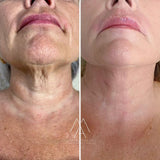 🐝 Botox Bee Venom Anti-Aging Cream