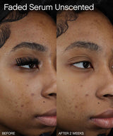 Faded Brightening & Clearing Serum