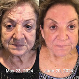 🐝 Botox Bee Venom Anti-Aging Cream