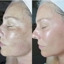Medicube™ PDRN Booster Gel